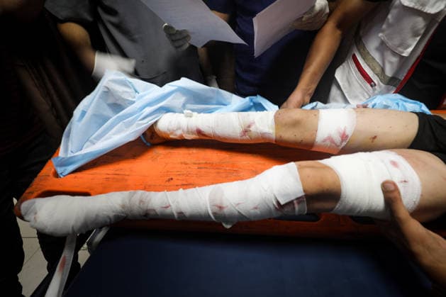 Nahostkonflikt, Gaza, Verletzte im Al-Awda Krankenhaus in Deir al-Balah