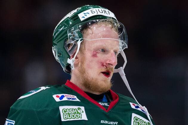 Themen der Woche - SPORT Bilder des Tages - SPORT 180130 Frölundas Simon Hjalmarsson lämnar isen med skada i ansiktet under ishockeymatchen i SHL mellan Frölunda och Djurgarden den 30 januari 2018 i Göteborg. Copyright: MICHAELxERICHSEN BB180130MI058