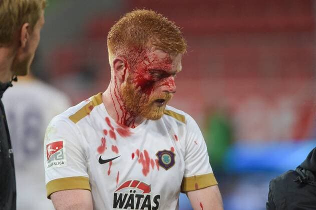 Sport Themen der Woche KW35 Sport Bilder des Tages Verlewtzung bei Fabian Kalig (FC Erzgebirge Aue 4), FC Ingolstadt 04 - FC Erzgebirge Aue, Fussball, 2 Bundesliga, 31.08.2018 DFL REGULATIONS PROHIBIT ANY USE OF PHOTOGRAPHS AS IMAGE SEQUENCES AND OR QUASI-VIDEO Ingolstadt Bayern Deutschland