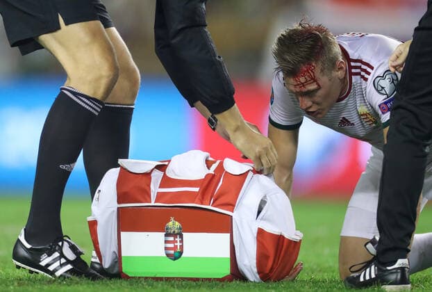 Bilder des Jahres 2019, Sport 10 Oktober Sport Themen der Woche KW41 Sport Bilder des Tages Fußball, EM Quali, Kroatien - Ungarn Adam Lang ozlijedio glavu u kontaktu s Rakitićem tijekom utakmice Hrvatska - MaÄ‘arska 10.10.2019., stadium Poljud, Split, Croatia - Qualifications for European Championship, EM, Europameisterschaft group E, round 6 , Croatia - Hungary. Adam Lang IgorxSoban PIXSELL