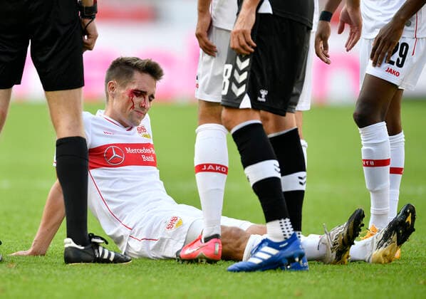 Bilder des Jahres 2020, Sport 09 September Sport Themen der Woche KW38 Philipp Klement VfB Stuttgart verletzt Verletzung butet am Kopf Kopfwunde Blut VfB Stuttgart vs SC Freiburg SCF 19.09.2020 DFL REGULATIONS PROHIBIT ANY USE OF PHOTOGRAPHS AS IMAGE SEQUENCES AND OR QUASI-VIDEO VfB Stuttgart vs SC Freiburg