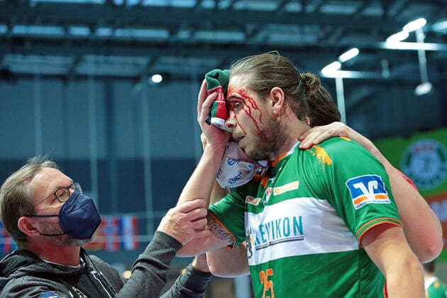 Bilder des Jahres 2021, Sport 02 Februar Sport Themen der Woche KW07 Sport Bilder des Tages 18.02.2021, xovx, Handball 1. Bundesliga, HSG Wetzlar - TSV Hannover-Burgdorf v.l. Olle Forsell Schefvert (HSG Wetzlar) schwer verletzt im Gesicht emspor Wetzlar