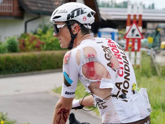 Bilder des Jahres 2021, Sport 06 Juni Sport Themen der Woche KW22 Foto Manuel Geisser 04.06.2021 Radsport Grosser Preis des Kantons Aargau. Gippingen Bild : Sturzopfer Mathias Frank (SUI) Team AG2R-Citroen Aktion