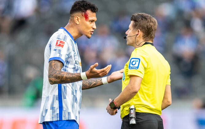 Bilder des Jahres 2021, Sport 10 Oktober Sport Themen der Woche KW39 Sport Bilder des Tages Berlin, 02.10.2021, Fussball, Bundesliga, 7. Spieltag, Hertha BSC - SC Freiburg, Olympiastadion. Berlins Davie Selke hat blutende Kopfwunde und spricht mit Schiedsrichter Patrick Ittrich (r). DFL regulations and DFB regulations prohibit any use of photographs as image sequences and or quasi-video, Foto: Andreas Gora Hertha BSC - SC Freiburg