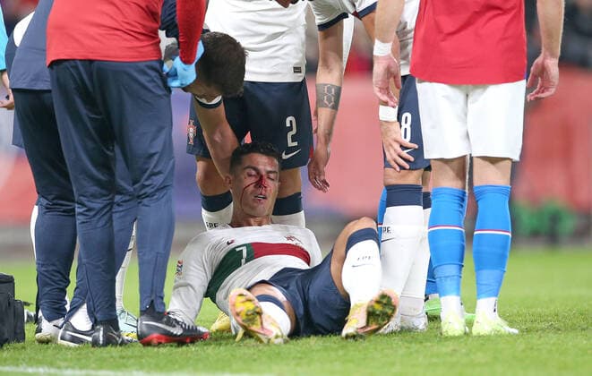 Bilder des Jahres 2022, Sport 09 September Sport Themen der Woche KW38 Sport Bilder des Tages Fußball, Nations League, Tschechien - Portugal, Cristiano Ronaldo blutet nach Zusammenprall 24.09.2022, Fussball Länderspiel UEFA Nations League 2022 23, Tschechische Republik - Portugal, in der Fortuna Arena Prag. Cristiano Ronaldo (Portugal) verletzt nach Zusammenprall und muss behandelt werden