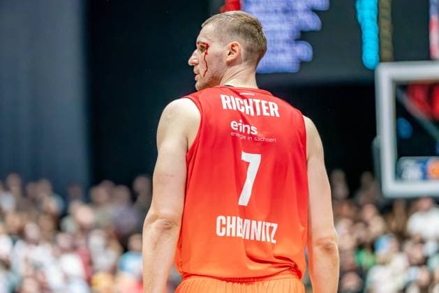 Bilder des Jahres 2024, Sport 11 November Sport Themen der Woche KW44 Sport Bilder des Tages Chemnitz, Deutschland 03. Oktober 2024: 1.BBL - 2024 2025 - Niners Chemnitz vs. BG Göttingen Im Bild: Jonas Richter (Chemnitz) am Kopf verletzt mit Blutung Copyright: xFotostandx xNachtigallx