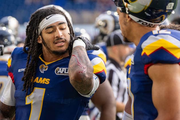 Cameron Bergeron (Alpine Rams, 01) blutet am Arm, GER Rhein Fire vs. Alpine Rams, American Football, AFLE, Saison 2026, 01.08.2026 GER Rhein Fire vs. Alpine Rams, American Football, AFLE, Saison 2026, 01.08.2026 Duisburg Copyright: xEibner-Pressefoto FabianxFriesex EP_FFE