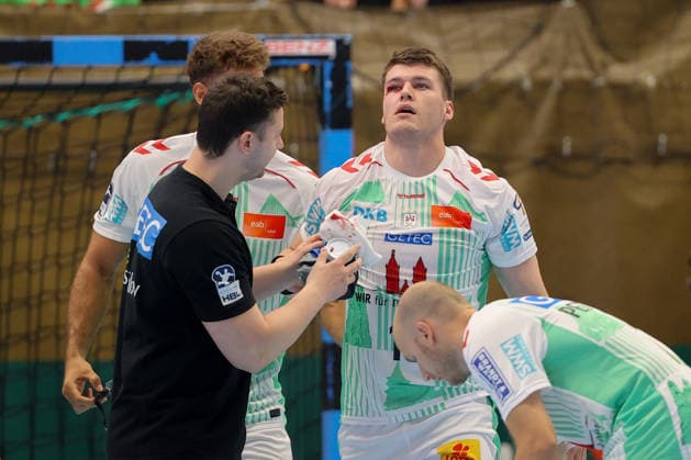 07.08.2026, xtgx, Handball Turnier, EHV Aue - SC Magdeburg emspor, v.l. Elvar Orn Jonsson (Magdeburg, 19) verletzt, Verletzung, Auge Lößnitz