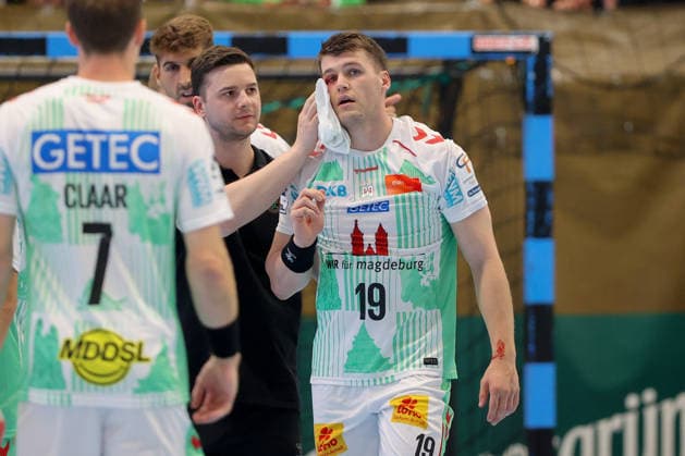 07.08.2026, xtgx, Handball Turnier, EHV Aue - SC Magdeburg emspor, v.l. Elvar Orn Jonsson (Magdeburg, 19) verletzt, Verletzung, Auge Lößnitz