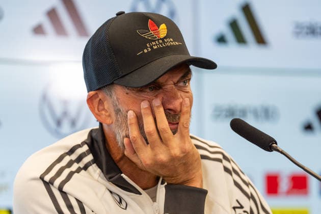 17.09.2026, GER, Nominierungs-Pressekonferenz UEFA Nations League 2026 2027 - mit Bundestrainer Jürgen Klopp Jürgen Klopp (Bundestrainer Chef-Trainer, Deutschland) Hände vor dem Gesicht, genervt, Gestik, Mimik, Emotionen Frankfurt DFB-Campus Frankfurt Deutschland Copyright: xnordphotoxGmbHx xChristianxSchulzex