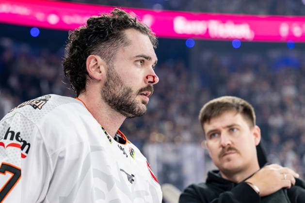 Matthew Wedman (Loewen Frankfurt, 67) mit kleinem Cut auf der Nase Portrait Portraet GER, EHC Red Bull Muenchen vs. Loewen Frankfurt Eishockey, DEL, Saison 2026 2027, 4. Spieltag, 27.09.2026. Foto: HMB Media Heike Feiner Copyright: HMBxMedia HeikexFeiner