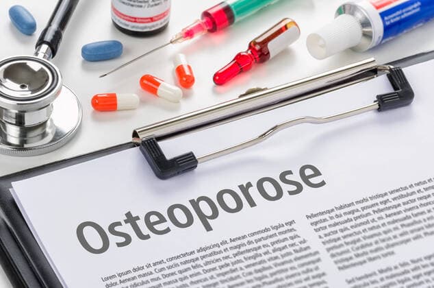 osteoporose,knochenschwund