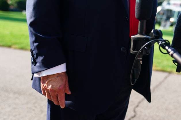 White House Coverage US President Donald Trump’s hand as he speaks to the media before leaving the White House, Washington, DC, USA, 25 July 2025. President Trump is due to visit Scotland for a 4 day visit where he is due to visit his golf courses and met with UK Prime Minister Keir Starmer. EPA-EFE WILL OLIVER POOL WASHINGTON DC United States  Copyright: xPool ABACAx