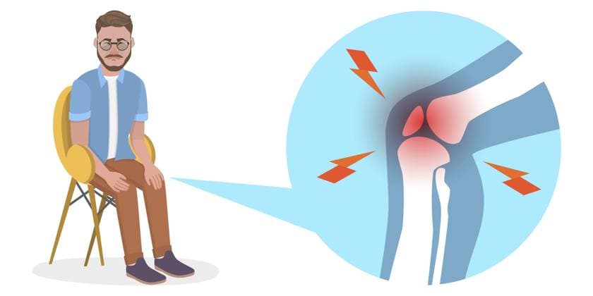 Isometrische, flache, konzeptionelle 3D Darstellung von Knieproblemen, entzündlicher Arthritis und Osteoporose, Gelenkentzündungen 3D Isometric Flat Conceptual Illustration of Knee Problems, Inflammatory Arthritis and Osteoporosis, Joint Inflammation Copyright: imageBROKER AnastasiiaxTorianyk ibxplw18146332.jpg