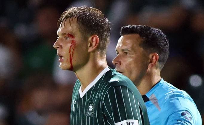 Mathias Ross of Plymouth Argyle with a bloody face Plymouth Argyle v Exeter City, EFL Carabao Cup, First Round, Football, Home Park, Plymouth, UK - 10 Aug 2026Plymouth Home Park United Kingdom EDITORIAL USE ONLY No use with unauthorised audio, video, data, fixture lists, club league logos or live services. Online in-match use limited to 120 images, no video emulation. No use in betting, games or single club league player publications. Copyright: xKieranxMcManus Shutterstockx 17061087bj
