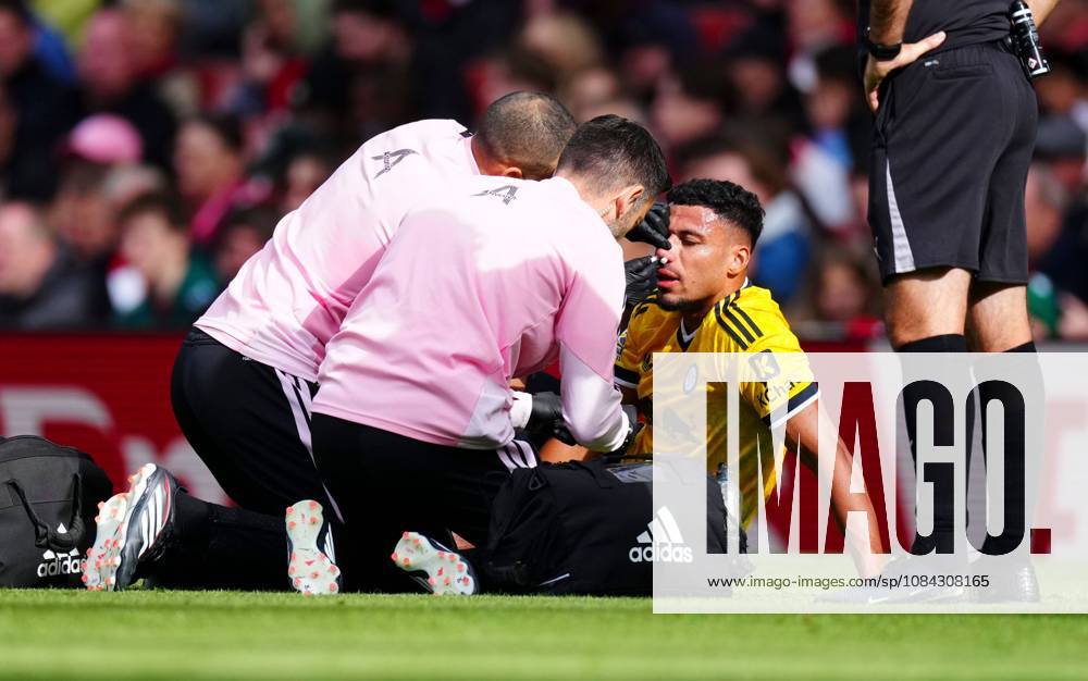 James Justin of Leeds United gets treatment on his nose Arsenal v Leeds United, Premier League, Football, Emirates Stadium, London, UK - 10 Oct 2026London Emirates Stadium United Kingdom