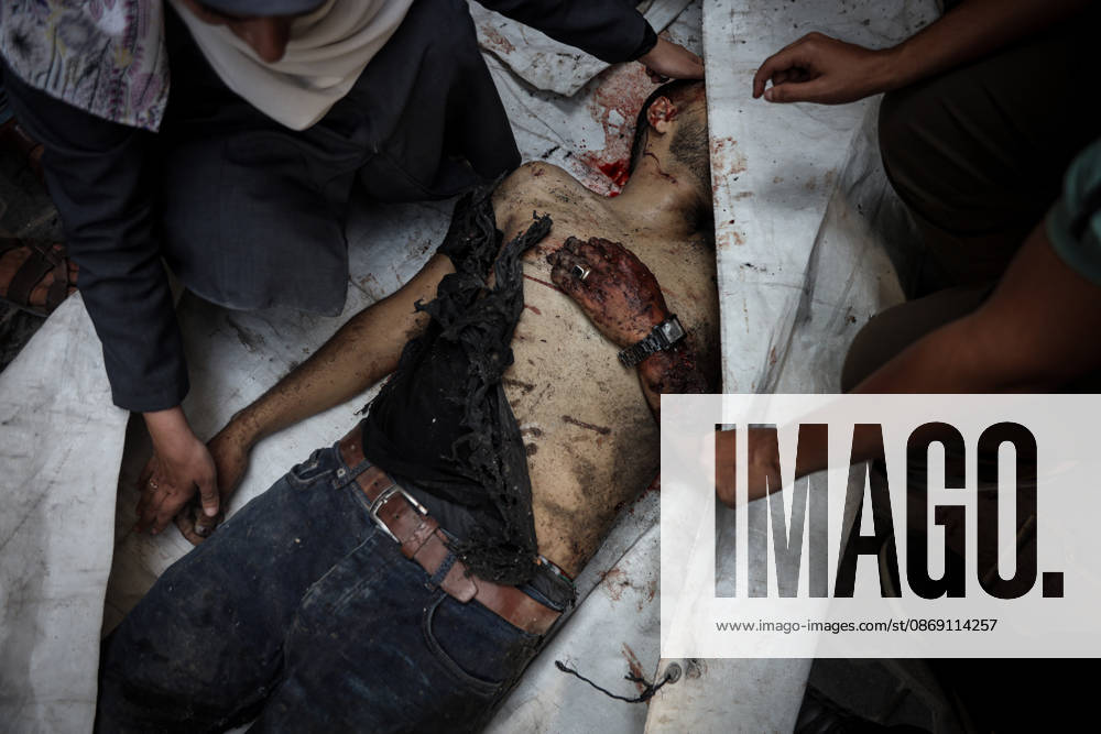 Israeli attacks continue on Gaza GAZA, PALESTINE - OCTOBER 10 : (EDITORS NOTE: Image depicts death) Palestinian deceased bodies who lost their lives after an Israeli airstrikes are brought to Al-Shifa Hospital in Gaza City, Palestine on October 10, 2026. Abdalhkem Abu Riash Anadolu Gaza City Gaza. Editorial use only. Please get in touch for any other usage.