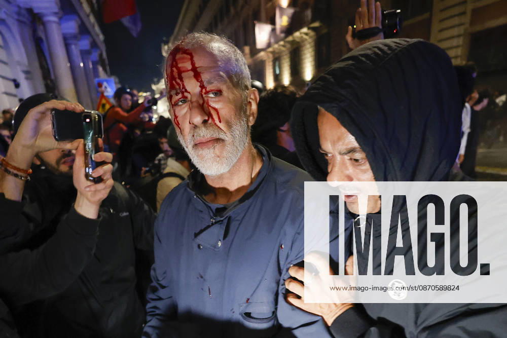 Demonstration against the Italian government in Rome ROME, ITALY, OCTOBER 24: (EDITOR S NOTE: Image depicts graphic content) A protester is seen after been wounded during clashes between Italian police and demonstrators against the Italian government in Rome, Italy, on October 24, 2026. Riccardo De Luca Anadolu Rome Italy. Editorial use only. Please get in touch for any other usage.