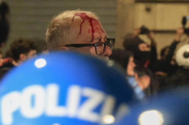 Demonstration against the Italian government in Rome ROME, ITALY, OCTOBER 24: (EDITOR S NOTE: Image depicts graphic content) A protester is seen after been wounded during clashes between Italian police and demonstrators against the Italian government in Rome, Italy, on October 24, 2026. Riccardo De Luca Anadolu Rome Italy. Editorial use only. Please get in touch for any other usage.  Copyright: x2026xAnadoluxRiccardoxDexLucax